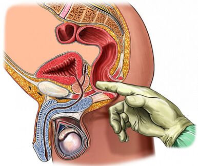 A finger study of the prostate