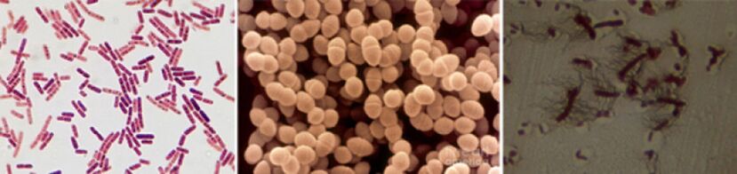 Escherichia -sticks, faecalerococci and pro - the main pathogenic of chronic bacterial prostatitis