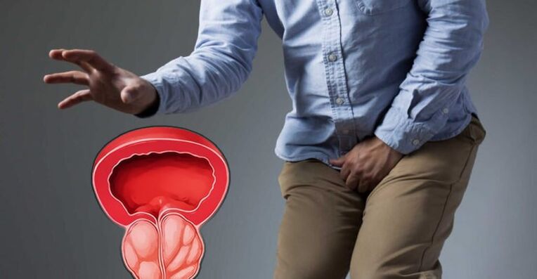 Prevention of prostatitis and prostate -adenoma