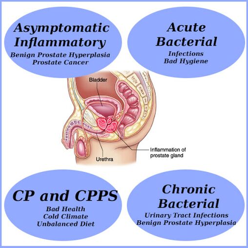 The causes of prostatitis